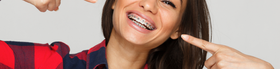 what are the different types of braces