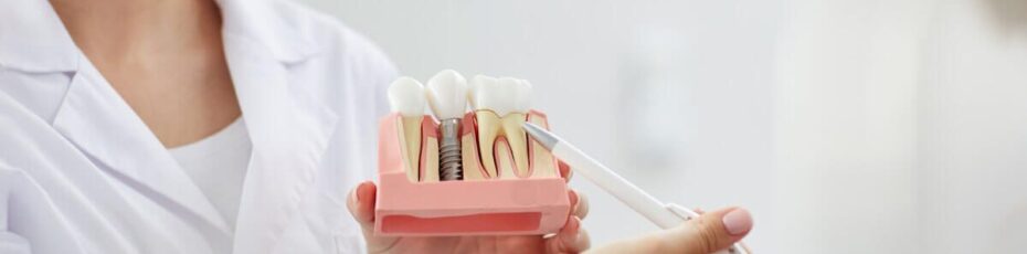 why are dental implants best for replacing missing teeth